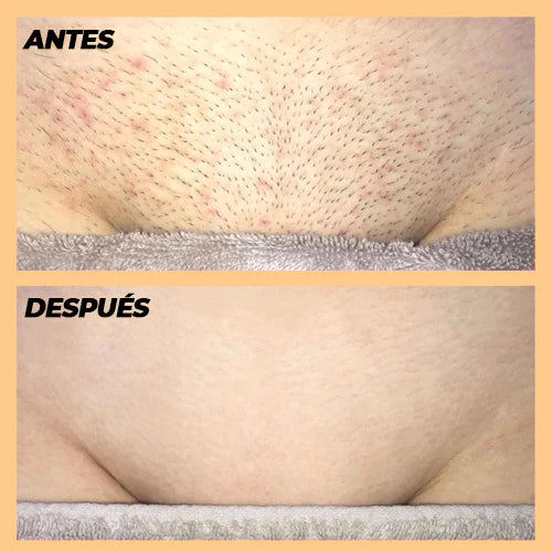 🚚 PAGO CONTRAENTREGA 🚚 FULL EPILATOR PRO - DEPILADORA LÁSER PIEL PERFECTA